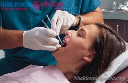 Nhổ răng tiểu phẫu trong nha khoa