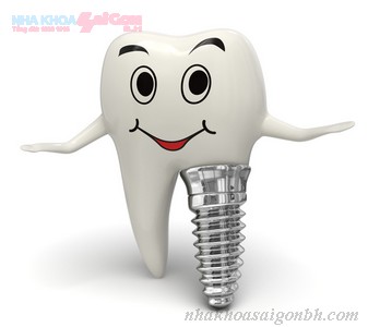 cắm ghép implant ngay khi nhổ răng