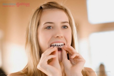 Quy trình tẩy trắng răng an toàn hiệu quả tại nhà