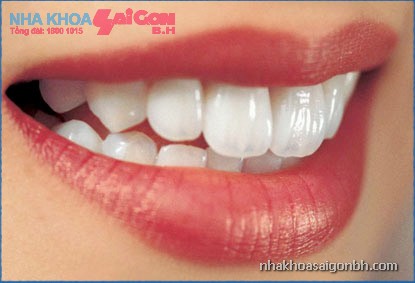 Mọi thứ bạn cần biết về răng sứ thẩm mỹ