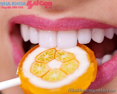 Trám răng thẩm mỹ – một lựa chọn hoàn hảo cho răng miệng bạn