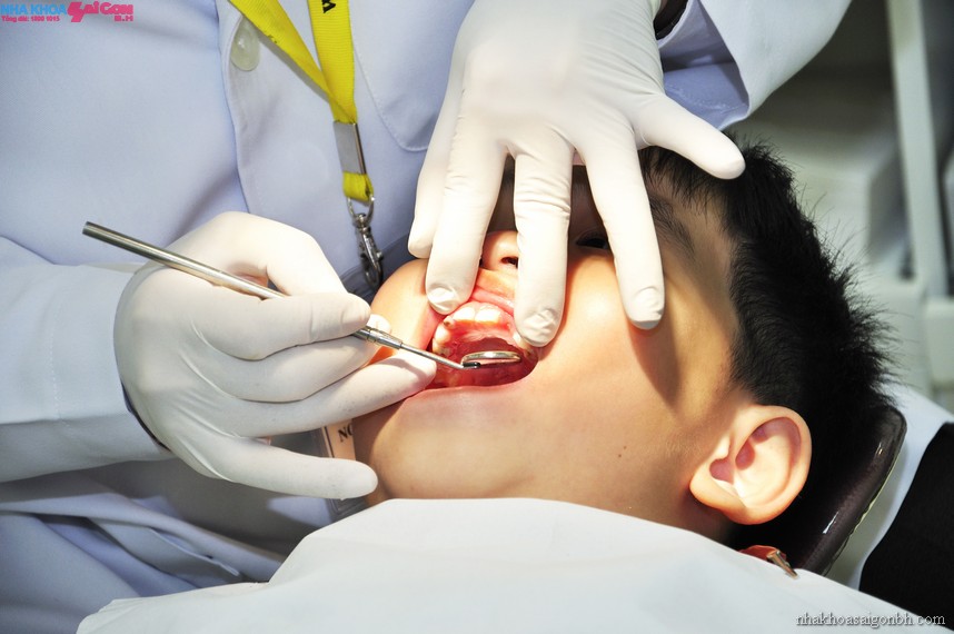 Điều trị tủy răng ở trẻ