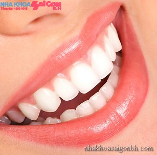 Cách giữ màu hiệu quả sau khi tẩy trắng răng