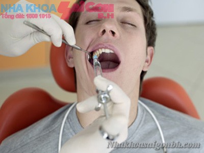 Sự thật về nhổ răng số 7 hàm dưới có nguy hiểm không?