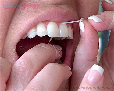 sử dụng chỉ nha khoa làm sạch kẽ răng