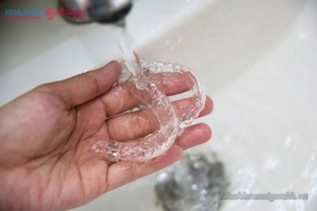 rửa sạch khay sau khi tẩy trắng răng tại nhà