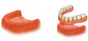 Trồng răng implant khác với trồng răng sứ ở điểm nào? 