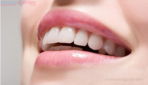 Bọc răng sứ thẩm mỹ có tác dụng gì?