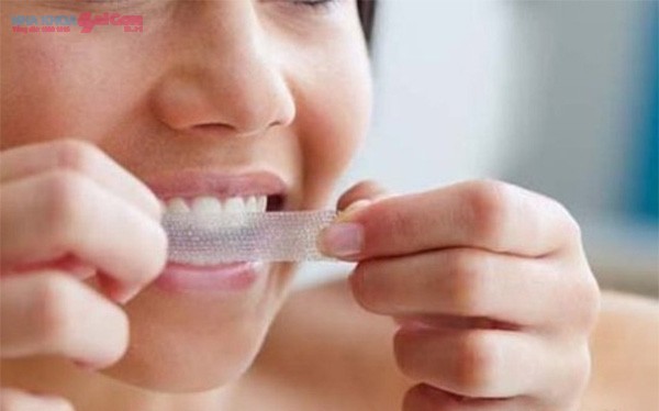 sử dụng miếng dán tẩy trắng răng tại nhà
