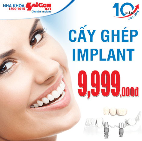 Trồng răng implant chỉ với 9,999.000đ