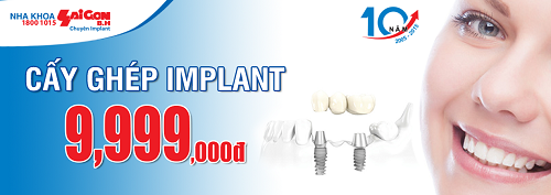 Cấy ghép implant trọn gói chỉ với 9,999,000 VNĐ