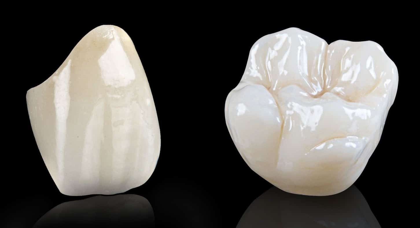 Thông tin về trồng răng sứ titan tại phòng khám nha khoa