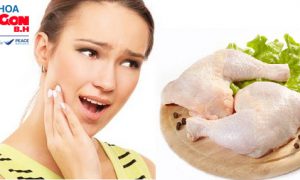 Bị đau răng có nên ăn thịt gà ?