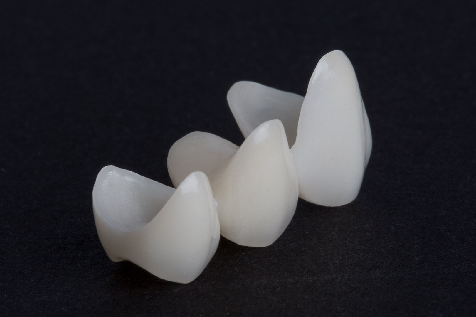 Các loại răng sứ phổ biến hiện nay là những loại nào?