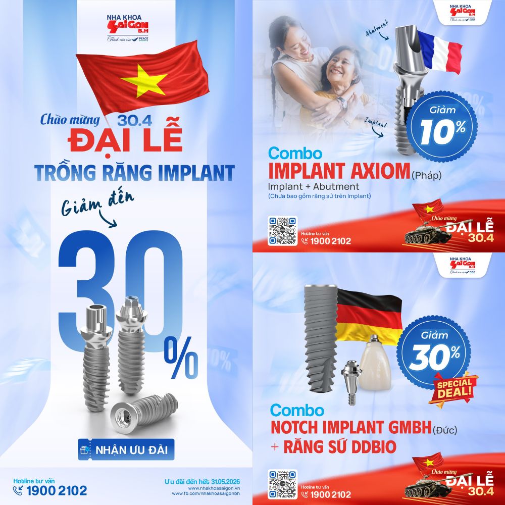 Ưu đãi cấy ghép Implant 30% – Nha Khoa Sài Gòn B.H Đại lễ 2026
